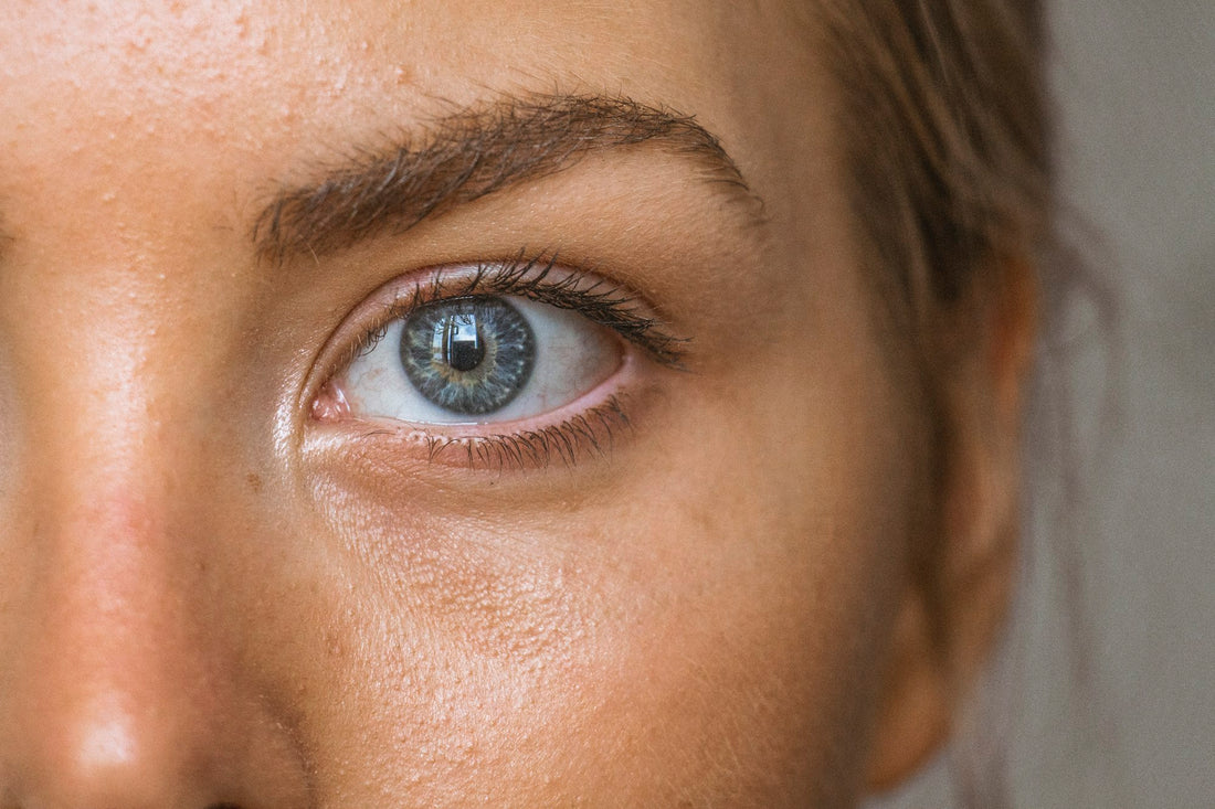 Close-up of a person's eye area, representing dark circles and puffiness skin concerns