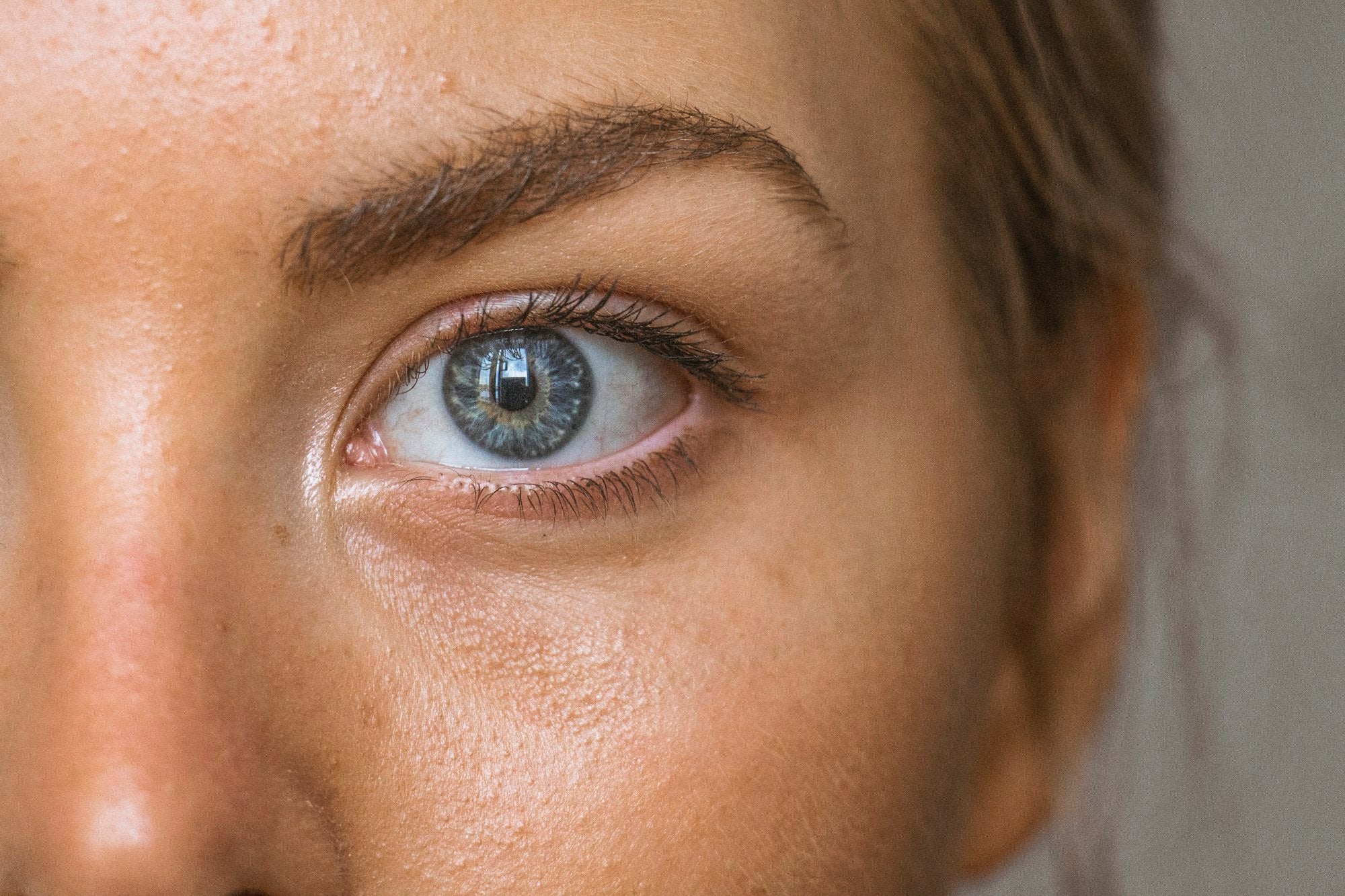 Close-up of a person's eye area, representing dark circles and puffiness skin concerns